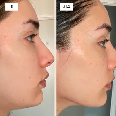 Gaine Visage Fit Mask