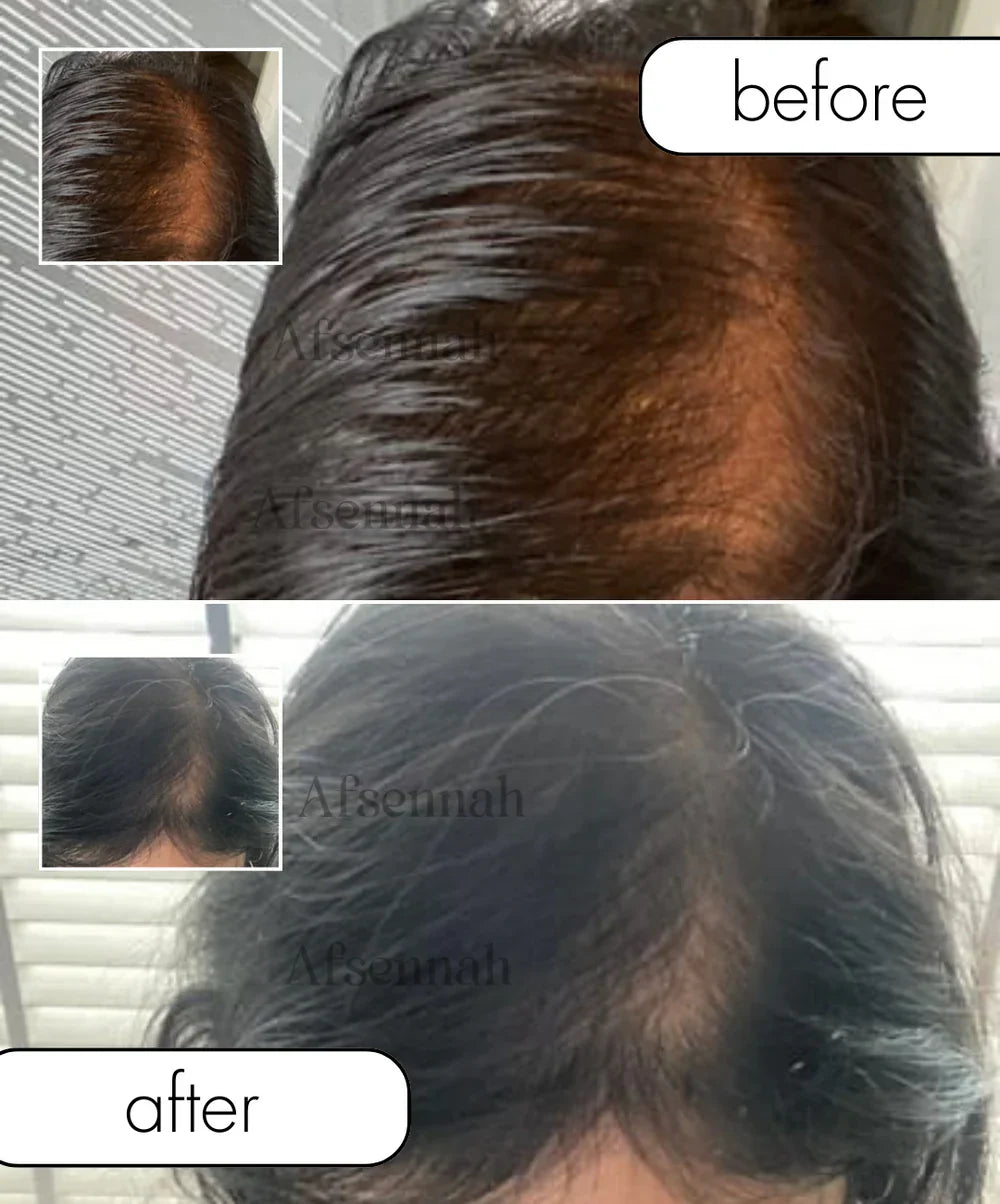 Custom Hair Growth Oil