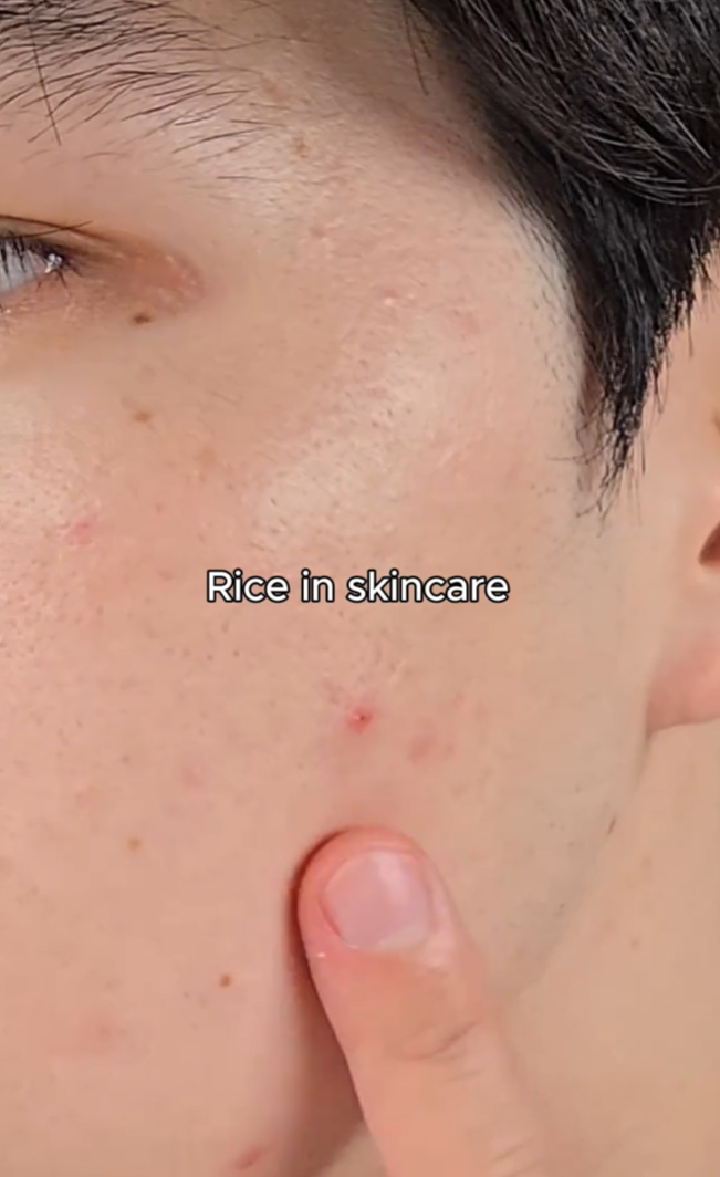 Dongzik™ Instant Peeling Gel