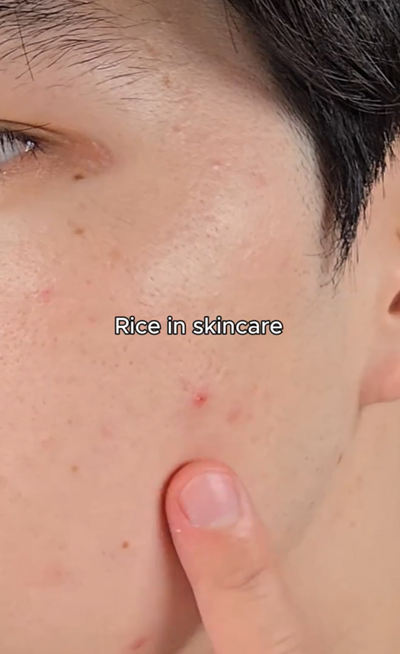 Dongzik™ Instant Peeling Gel